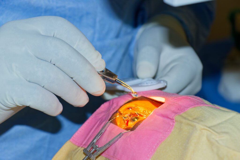 Free Eye Camp in Kwale County